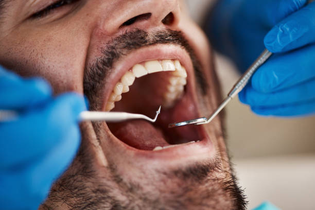 Best Dentist for Tooth Abscess  in Emerson, GA